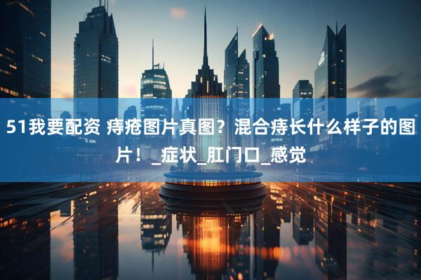 51我要配资 痔疮图片真图？混合痔长什么样子的图片！_症状_肛门口_感觉